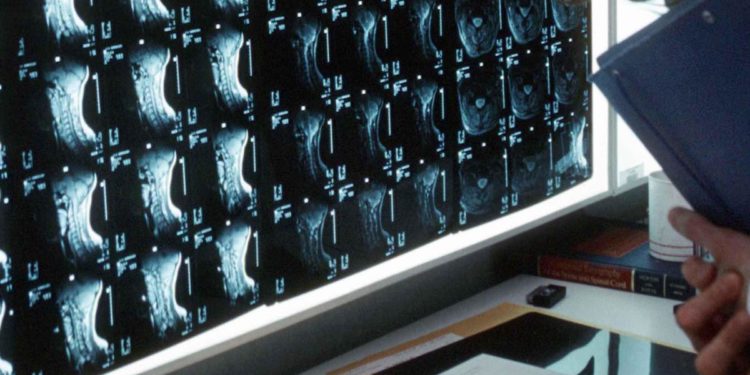 Fismad: “Un tumore su 4 è al sistema digerente ma per Covid molte diagnosi mancate”