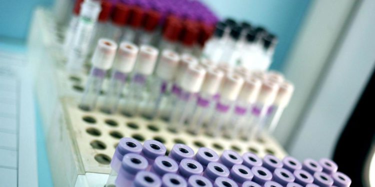 Variante Omicron 2, più contagi ma sintomi lievi: studio