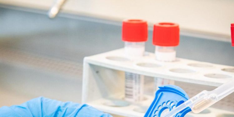 Covid, immunità innata anche contro Omicron: sfida di 2 scienziate italiane