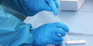 Covid oggi Veneto, 4.910 contagi e 21 morti: bollettino 18 febbraio