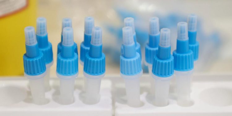 Covid Italia, tamponi e saturimetro nel paniere Istat