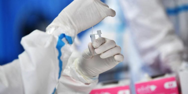 Covid oggi Basilicata, 431 contagi e 2 morti: bollettino 7 febbraio