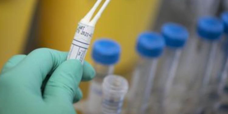 Covid oggi Piemonte, 2.244 contagi e 4 morti: bollettino 10 marzo