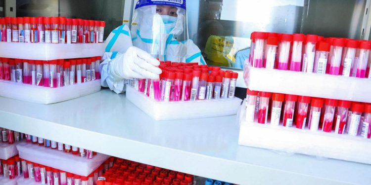 Covid oggi Basilicata, 494 contagi e 3 morti: bollettino 4 marzo