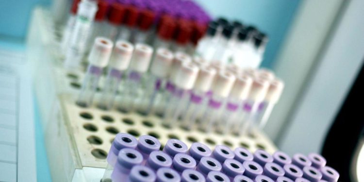 Covid oggi Vda, 52 contagi e un morto: bollettino 1 marzo