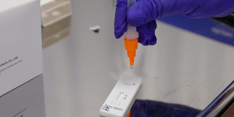 Covid oggi Sardegna, 1.480 contagi e 10 morti: bollettino 1 marzo