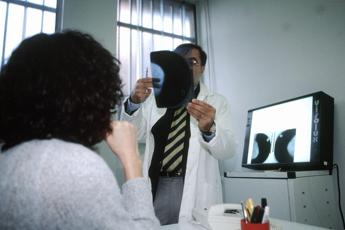 Schillaci, ‘oltre 50% cittadini non risponde a chiamata screening’