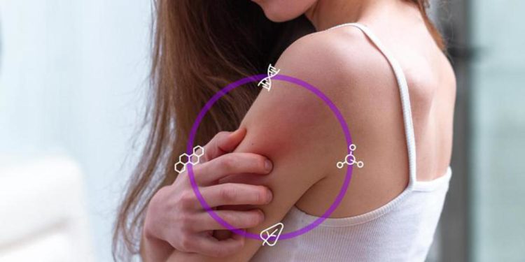 Dermatite atopica, al via nuova campagna dedicata ai pazienti