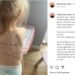 Guerra Ucraina, bimba con nome scritto addosso in caso madre muoia: la foto simbolo