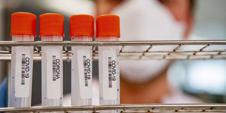 Covid, nuova variante Xj isolata per la prima volta in Italia