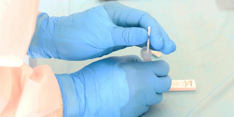 Covid oggi Veneto, 6.928 contagi e 10 morti: bollettino 8 aprile