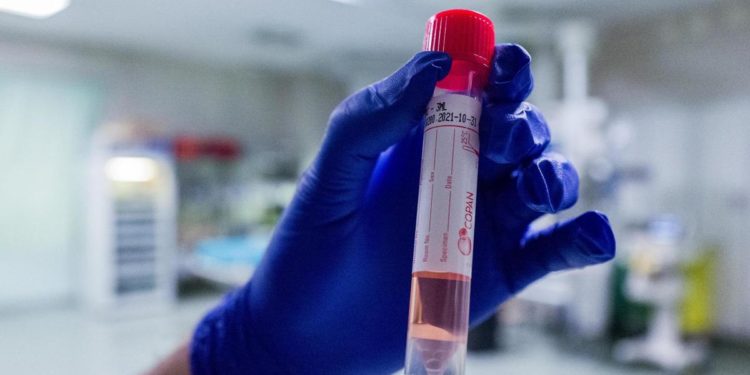 Covid oggi Lombardia, 2.560 contagi e 13 morti: a Milano 481 casi