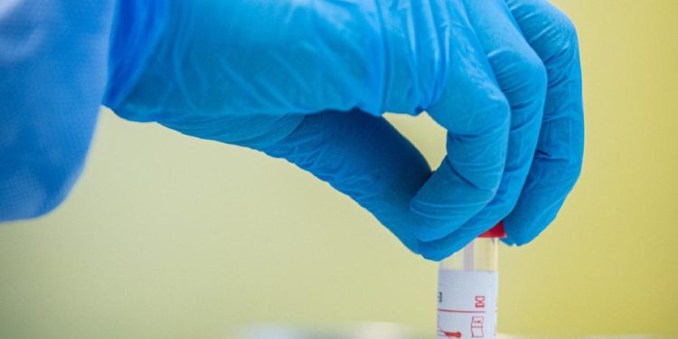 Covid oggi Campania, 3.384 contagi e 6 morti: bollettino 4 aprile