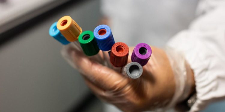 Covid oggi Campania, 10.099 contagi e 13 morti: bollettino 5 aprile