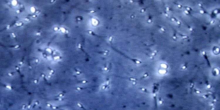 Covid, studio: proteina ‘chiave’ infezione trovata in spermatozoi