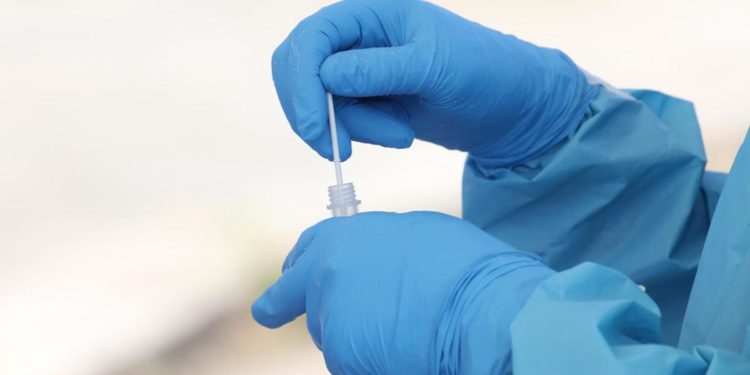 Covid oggi Sicilia, 1.993 contagi: bollettino 4 aprile