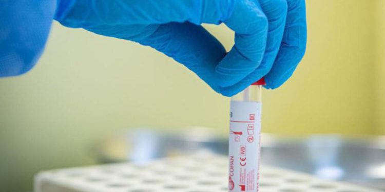 Covid oggi Toscana, 3.763 contagi: bollettino 28 aprile