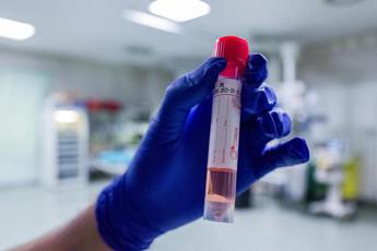 Covid oggi Calabria, 618 contagi e 2 morti: bollettino 4 dicembre