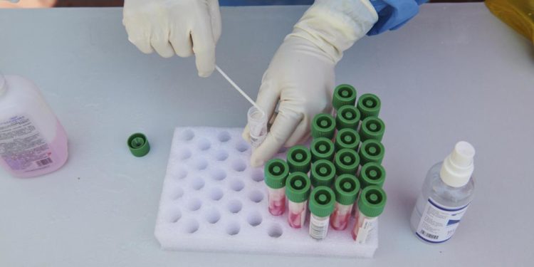 Covid oggi Vda, 70 contagi e nessun morto: bollettino 14 maggio