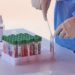 Covid Italia, primi casi di Ba.4: sottovarianti più contagiose ed evadono risposta immunitaria