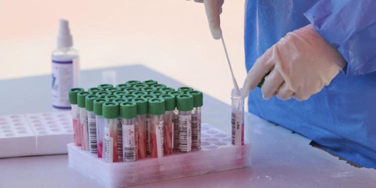 Covid Italia, aumentano reinfezioni: al 5,8% in ultimi 7 giorni