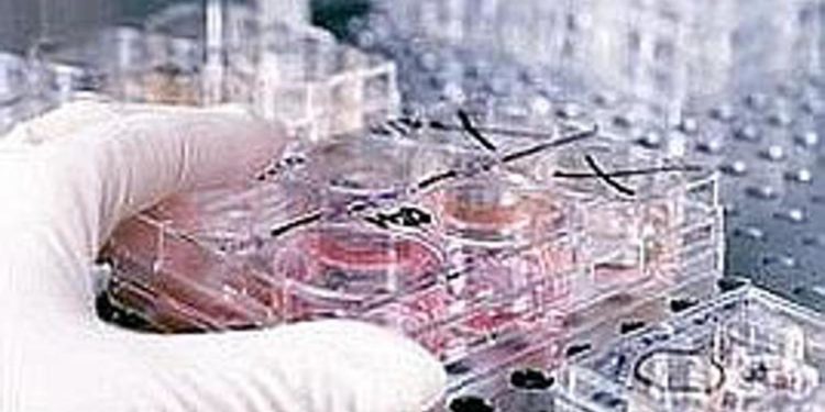 Vaiolo delle scimmie, primo caso in Australia