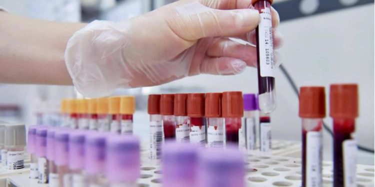 Covid oggi Emilia, 1.873 contagi e 14 morti: bollettino 16 maggio