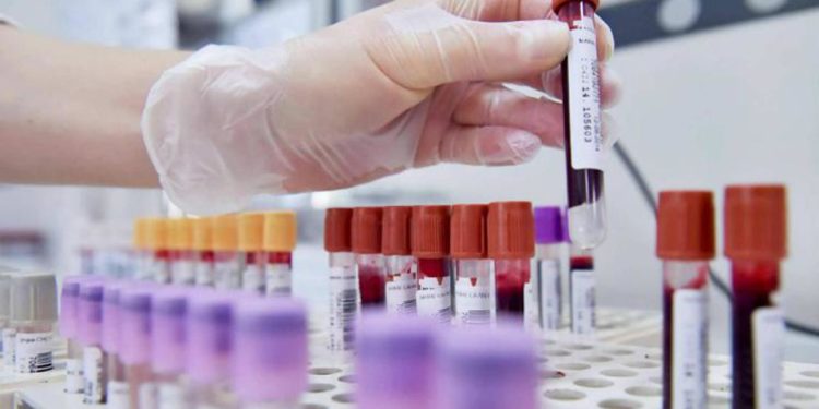Beta-talassemia grave colpisce 5mila italiani, 8 maggio Giornata mondiale