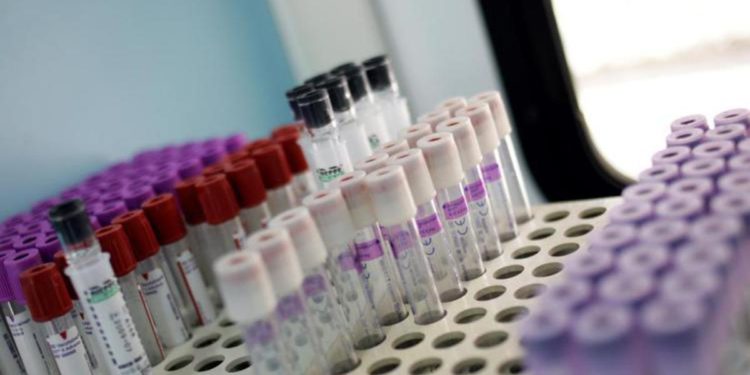 Vaiolo delle scimmie, Greco: “Migliaia di casi? Fantascienza mediatica”