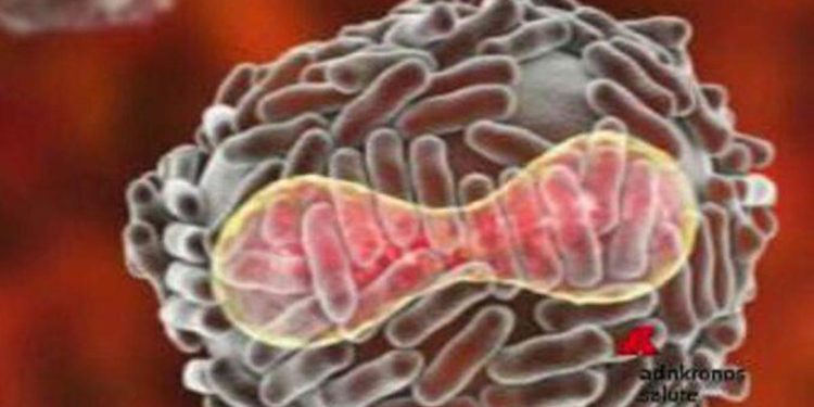 Vaiolo delle scimmie e quarantena: cosa dicono Bassetti, Gismondo, Pregliasco