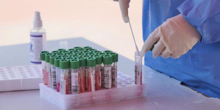 Covid oggi Lazio, 4.939 contagi e 6 morti. A Roma 2.954 casi