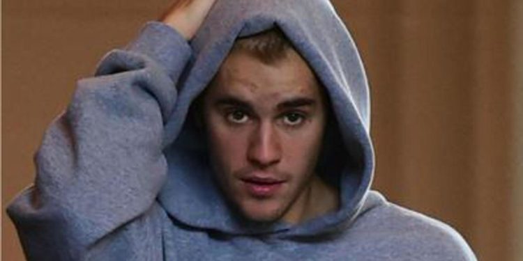 Lyme, cos’è la malattia che ha colpito Justin Bieber e altre star