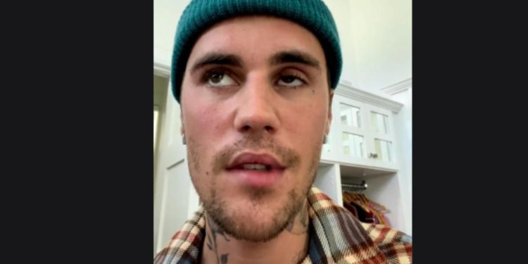 Justin Bieber colpito da paralisi facciale