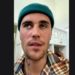 Justin Bieber colpito da paralisi facciale