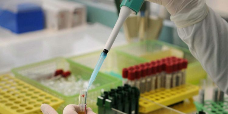 Vaiolo scimmie, primo caso a Torino