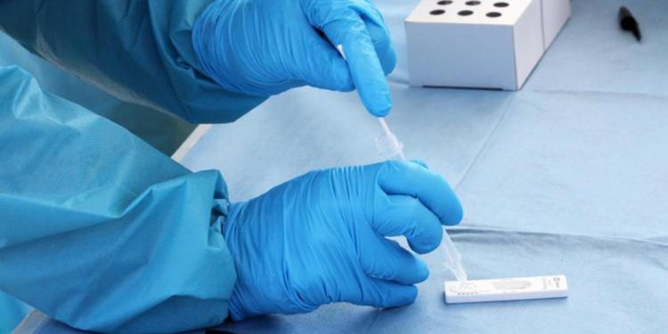 Covid oggi Calabria, 601 nuovi contagi e 5 morti: bollettino 1 giugno