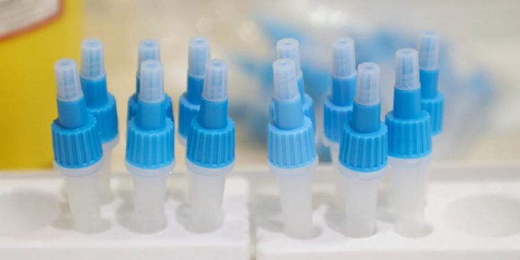 Omicron 5, Gismondo: “E’ come un’influenza”