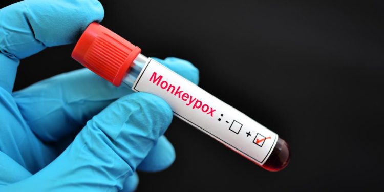 Vaiolo scimmie, Bassetti: “Numeri da epidemia”