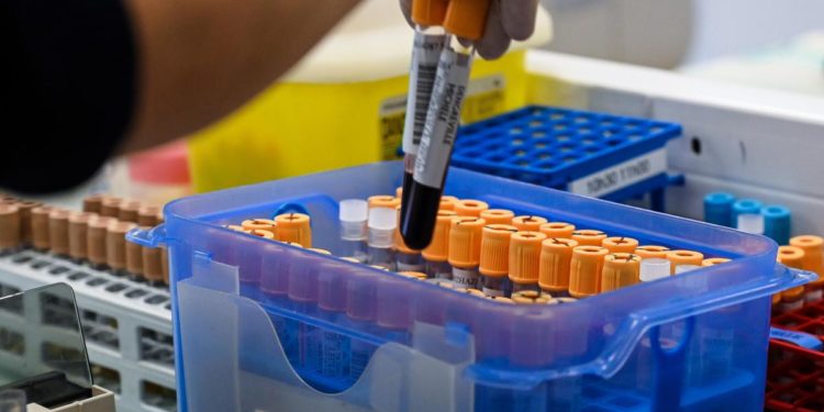 Covid oggi Calabria, 447 contagi e 4 morti: bollettino 20 giugno