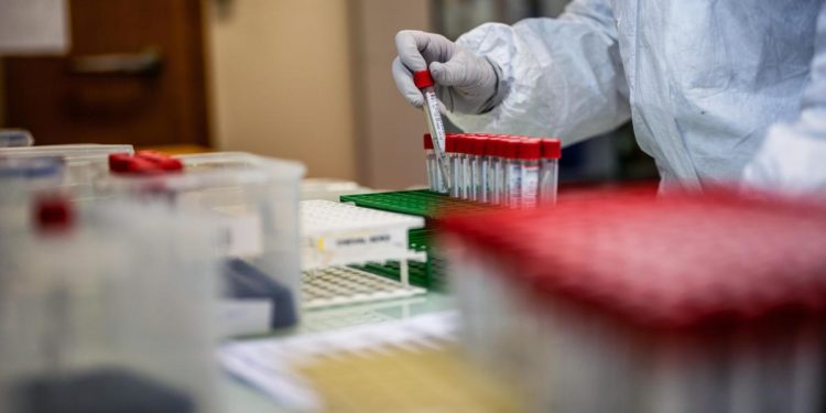 Covid oggi Italia, 120.683 contagi e 176 morti: bollettino 19 luglio