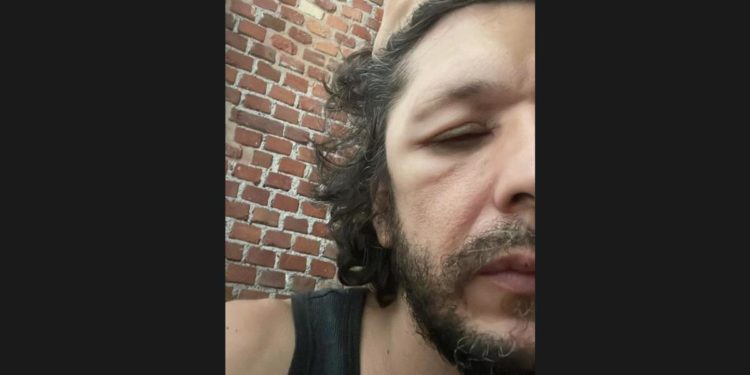 Ermal Meta annulla concerti: “Ma non sto morendo…”