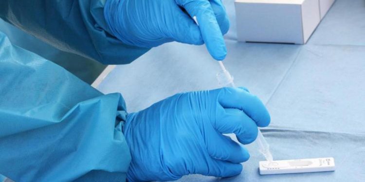 Covid oggi Lazio, 3.708 casi e 14 decessi. A Roma 1.962 casi