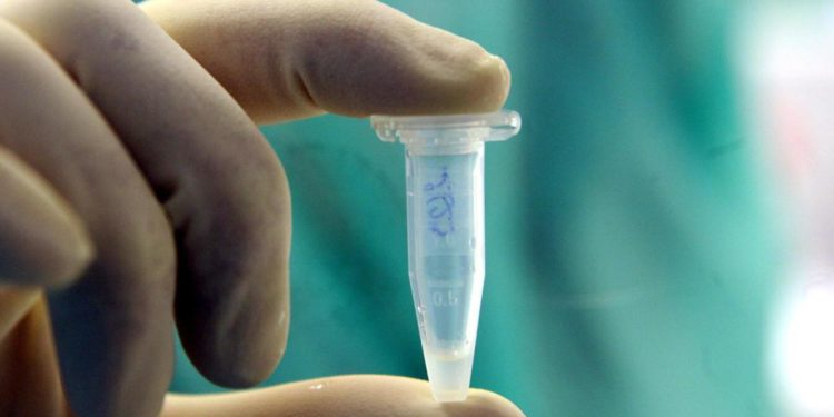 Vaiolo scimmie, caso in bimbo under 10: contagio ignoto