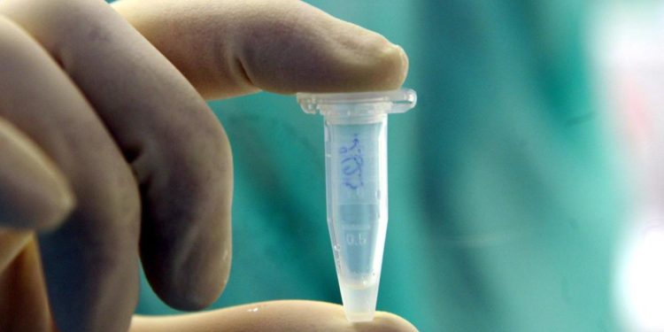 Virus Marburg, cos’è e sintomi: perché se ne riparla