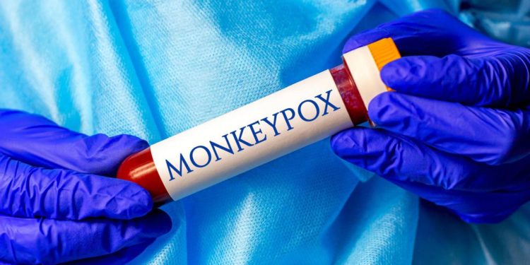 Vaiolo scimmie, ok Ema a vaccino vaiolo anche per Monkeypox