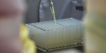 Vaiolo delle scimmie, in Italia +45 casi in 3 giorni