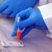 Test Covid, istruzioni per l’uso. I consigli dei microbiologi: “Ma no al tamponificio”