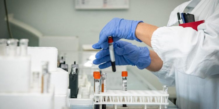 Covid, Cnr: nuovo test del sangue misura anticorpi neutralizzanti