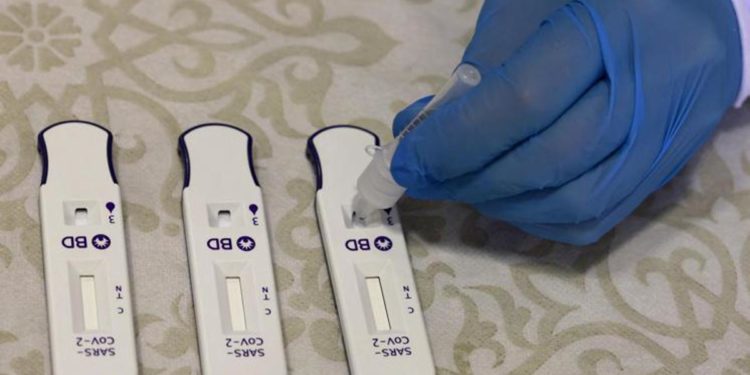 Covid oggi Italia, 181.181 contagi e 549 morti: ultimo bollettino