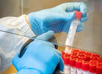 Covid Abruzzo, 4.526 contagi e 14 morti: bollettino ultima settimana